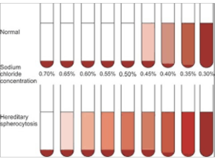 Osmotic Fragility Test Of Red Blood Cells Principle Procedure