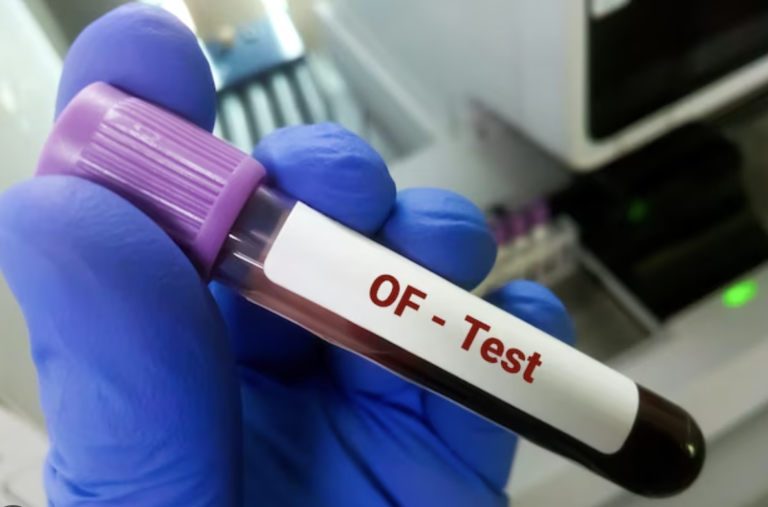 Osmotic fragility test of red blood cells: principle, procedure ...